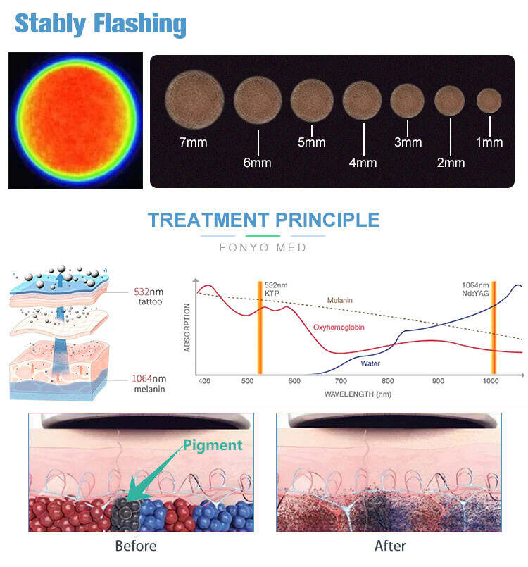 wholesale picosecond laser