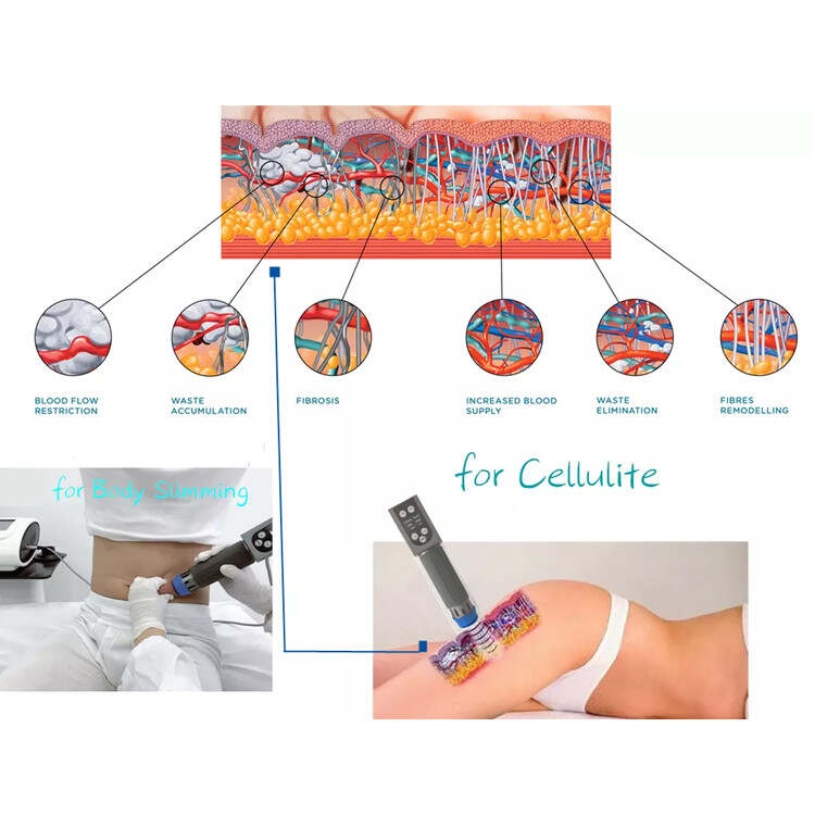 linear shockwave therapy eswt for erectile dysfunction