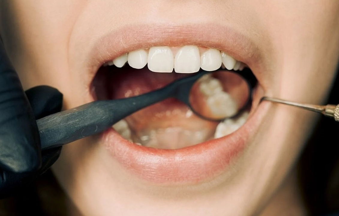 How does bad oral hygiene affect your health?