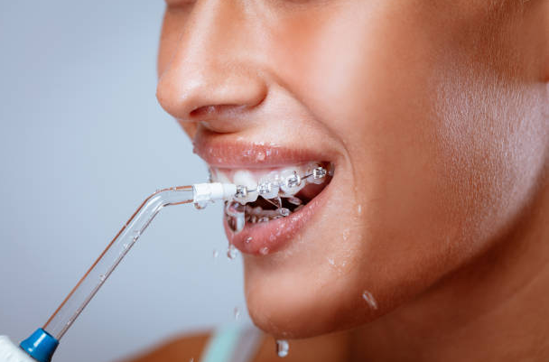 How to Use an Oral Irrigator: A Step-by-Step Guide for Effective Oral Hygiene