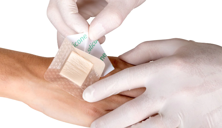 The Ultimate Guide to Foam Dressings for Wound Care: What You Need to Know