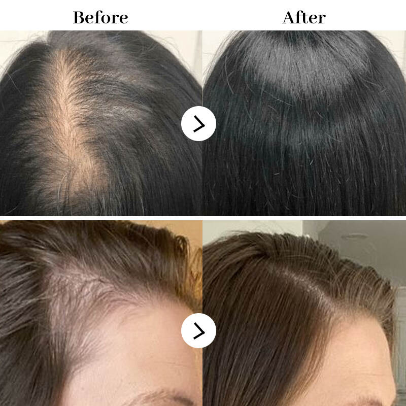 hair growth; hair care; hair shampoo; stimulating hair; hair restore; shampoo; hair growing