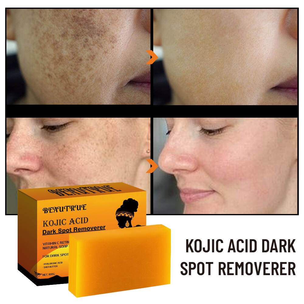 Kojic Acid Dark Spot Soap;soap;soap bars;