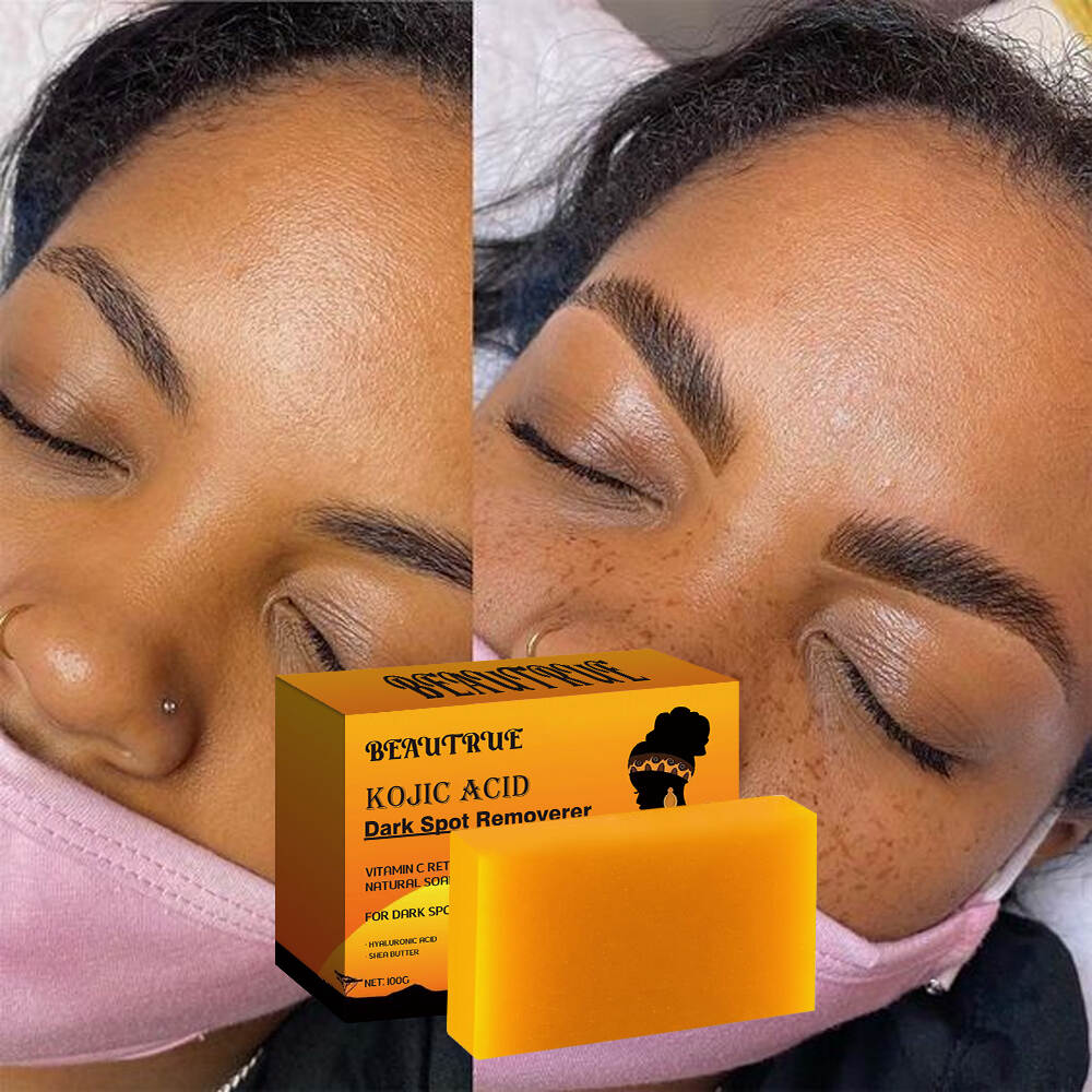 YOUR LOGO Kojic Acid Dark Spot Remover Soap Bars with Vitamin C Retinol Collagen Turmeric Original Japanese Complex Infused