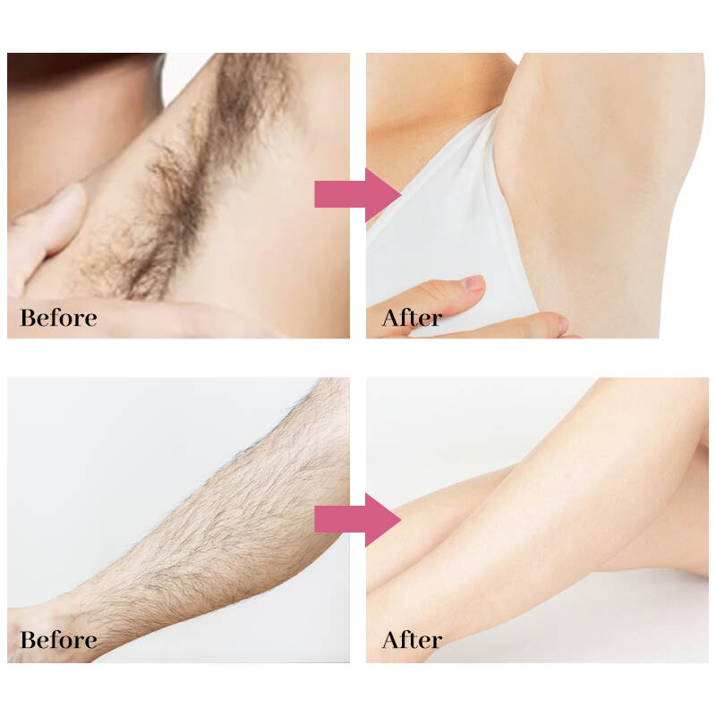 Hair Removal Mousse;Hair Removal foam;hair removal spray