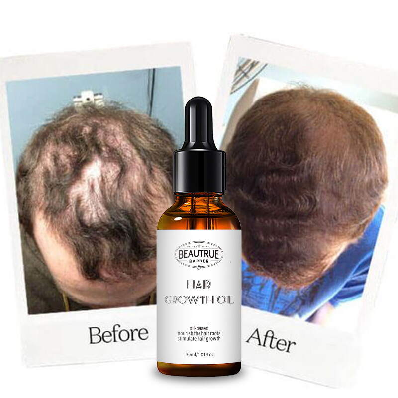 YOUR LOGO Hair Growth Oil Scalp Strengthening Nourishing Treatment for Dry Damaged Hair Healthy Growth