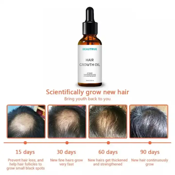 Hair Growth Oil;hair oil