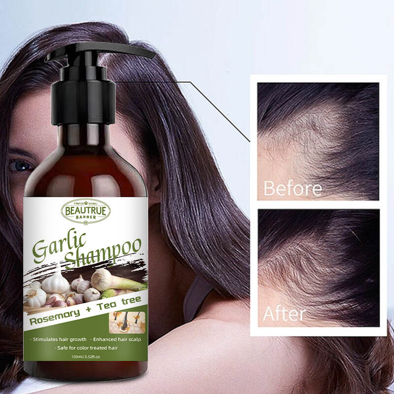 Garlic Shampoo