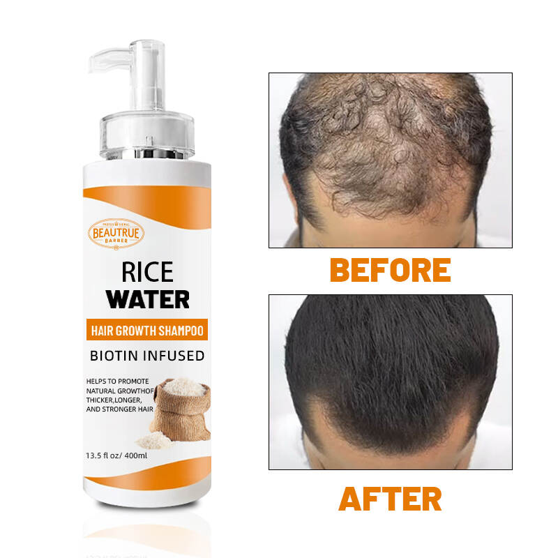 YOUR LOGO Hair Growth Rice Water Shampoo for Thinning Hair and Hair Loss