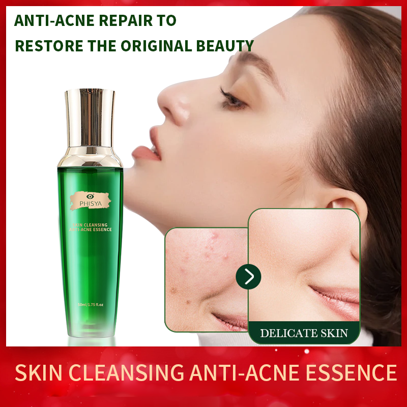 Acne Treatment Products for Oily Acne Prone Skin Blemish Control Breakout Prevention Sebum Reduction Skin Care Set