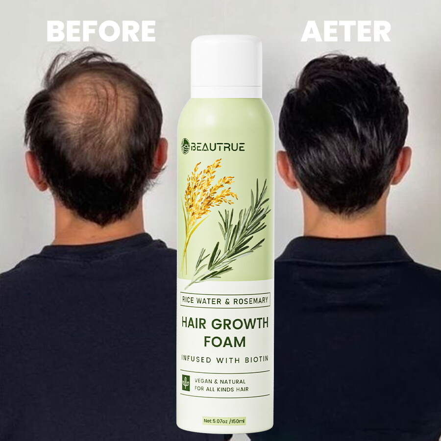 YOUR LOGO Rice Water Foam for Hair Growth with Rosemary Oil & Biotin