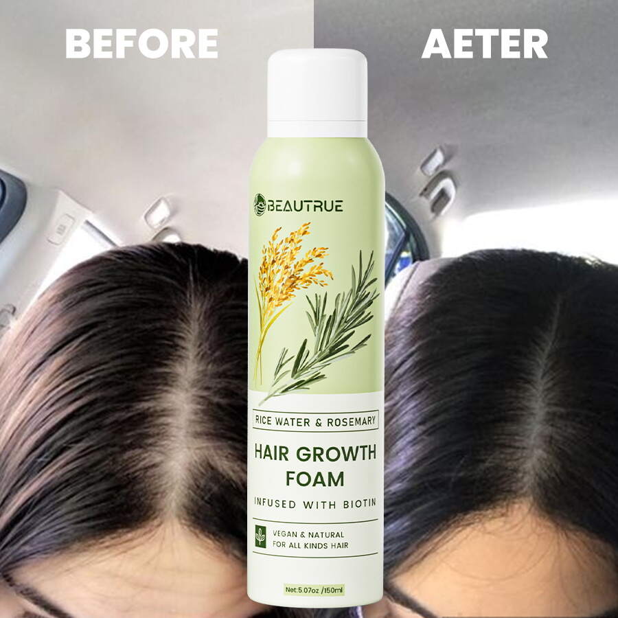 hair spray;hair growth foam;hair growth foam;rice water foam