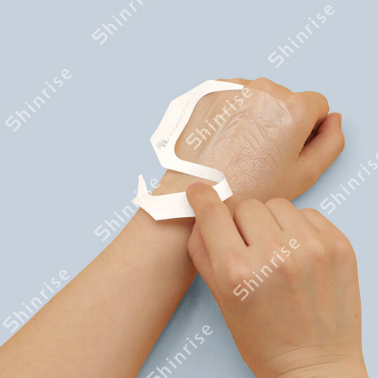 semi permeable film wound dressing