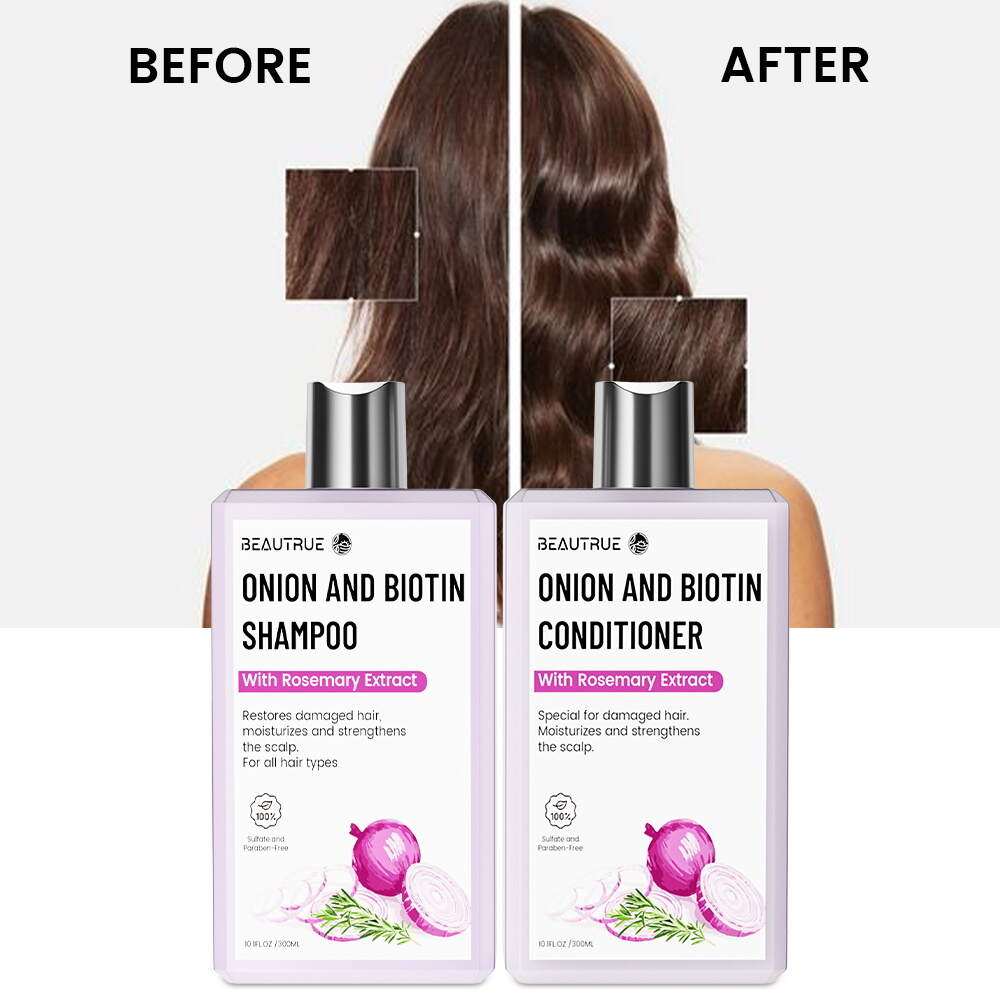 shampoo;conditioner;shampoo conditioner;onion shampoo set;onion shampoo