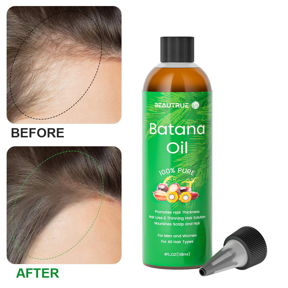 Batana Oil;hair oil;hair growth oil