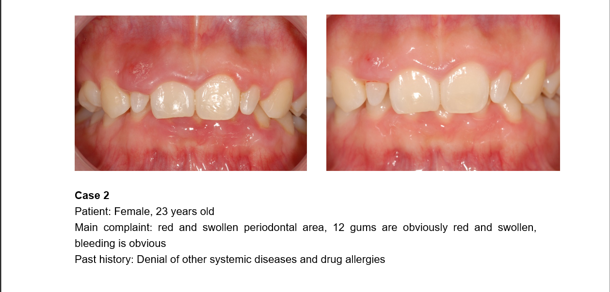 There are three clinical application cases for reference