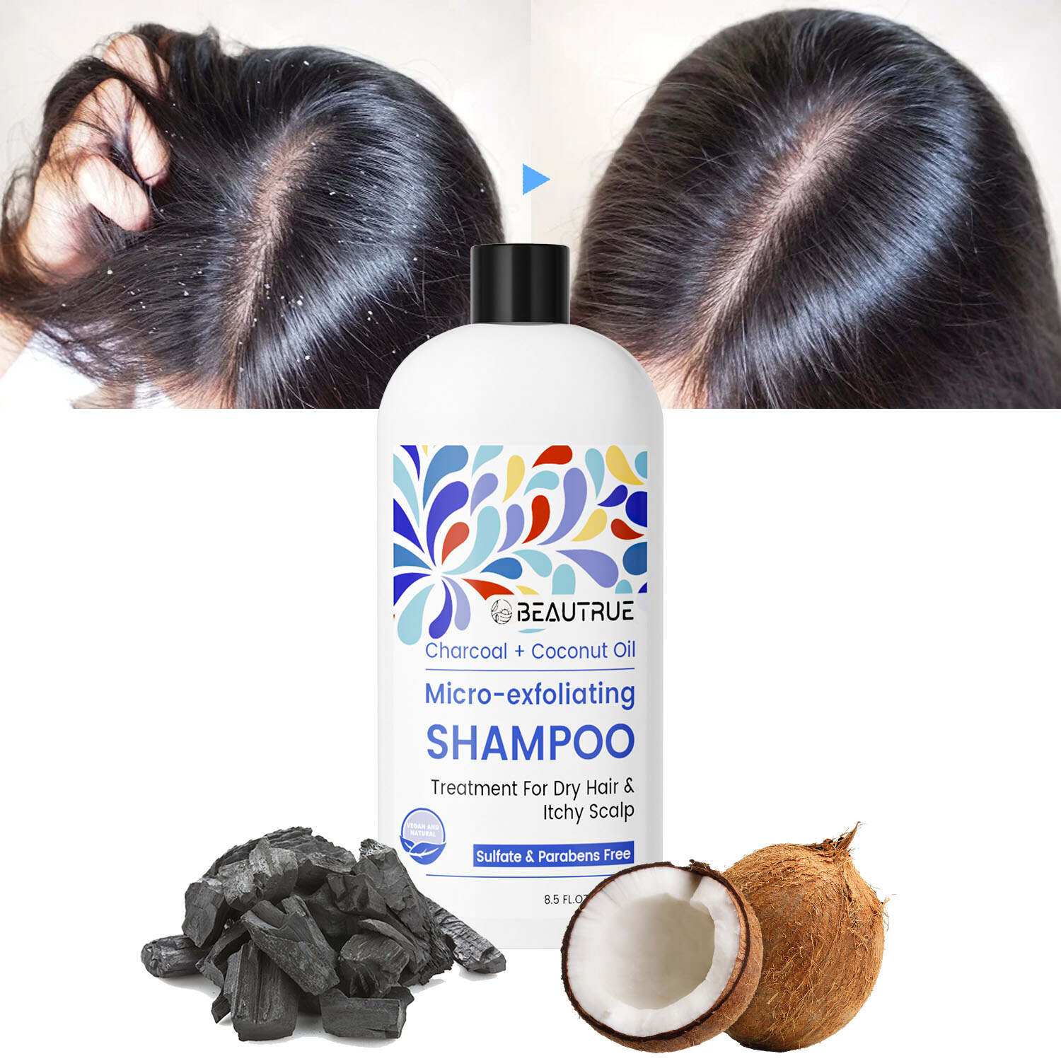 YOUR LOGO Scalp Revival Exfoliator Charcoal Coconut Oil Shampoo Treatment for Dry & Itchy Scalp Clarifying Shampoo for Build Up