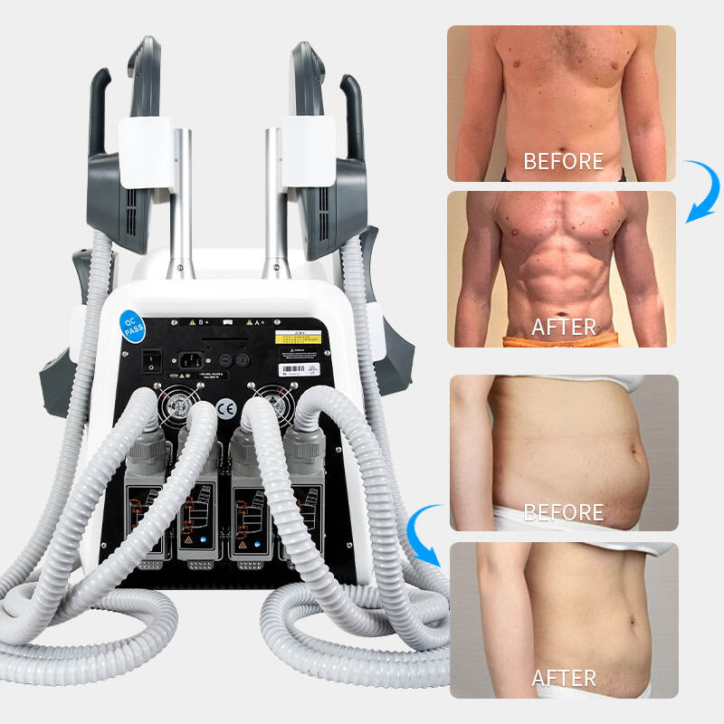 Factory price emsculpt machine rf China; ems sculpting machine before and after; Calime emslim treatment