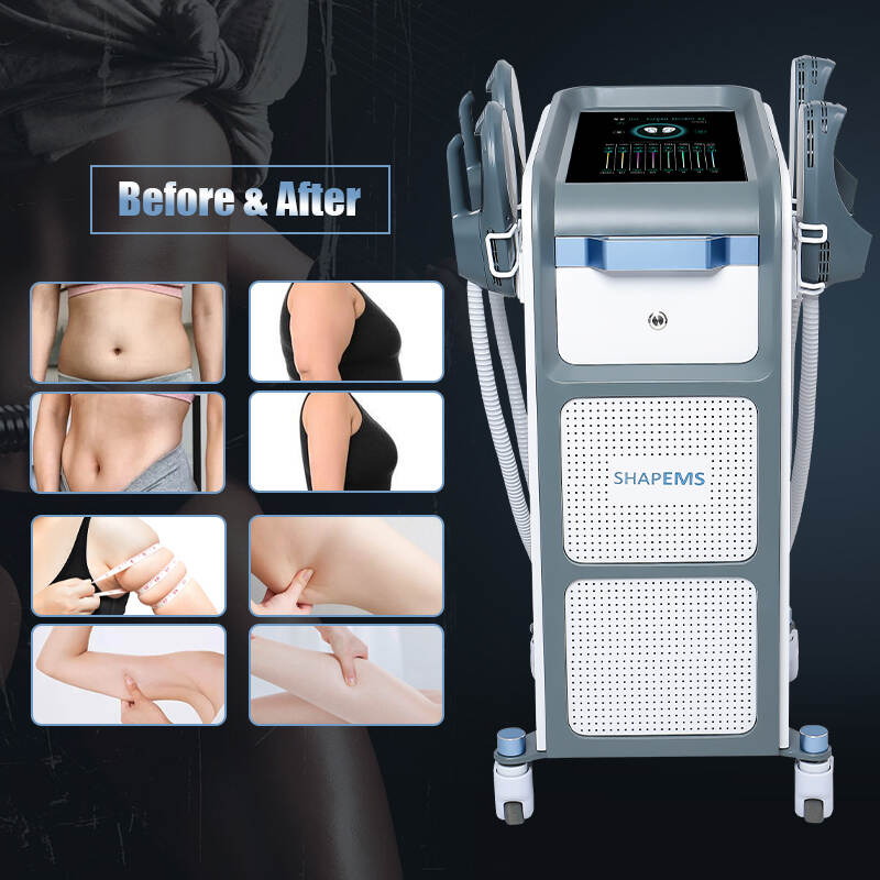 EMS sculpting machine effect; best ems sculpting machine; emsculpt for sale