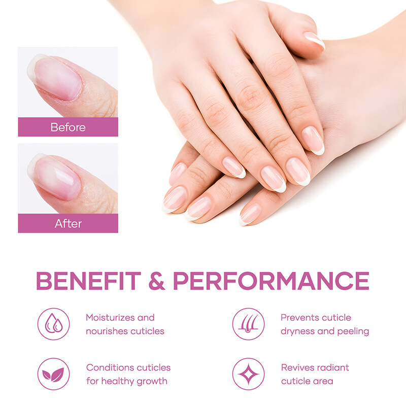 Professionele nagelriemolie, niet-toxische nagelriemolie, nagelriemolie voor acrylnagels, groothandelschutpelolie, bulkschutpelolie, privé-etiket nagelriemolie, fabrikant van cuticulaolie, cuticle-oliepengroothandel, mini-cuticle olie, aangepaste cuticle-olieformule, B2B nagelzorg, B2B nagelzorg. leverancier, nagel salon levert groothandel