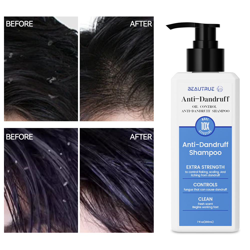 Anti-Dandruff Shampoo;scalp care shampoo;hair care shampoo;shampoo