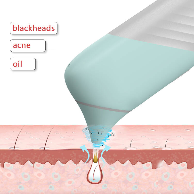 USB -Aufladungs ​​-Schönheitswerkzeug Blackhead -Entfernungsgerät, China Multi funktionale Schönheitsausrüstung, OEM Face Beauty Equipment