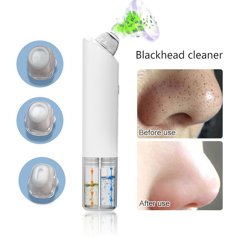 Dispositivo de limpiador de poros faciales del removedor de Blackhead