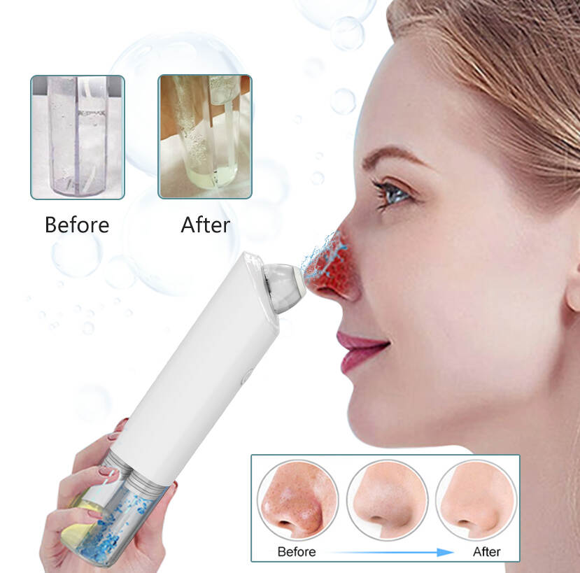 Blackhead Remover Yüz Gözenek Temizleyici Cihazı