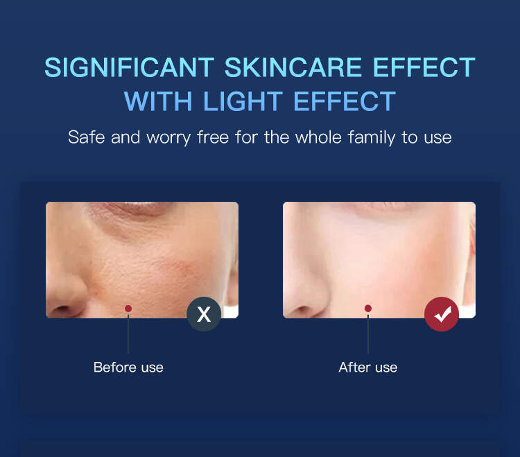 Red Light Therapy For Face Acne, Red Light Therapy For Face Wrinkles, Red Light Therapy For Spray