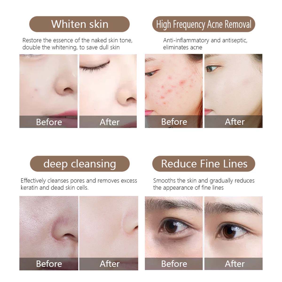 hydrafacial machine for sale,hydrofacial machine,best hydrafacial near me