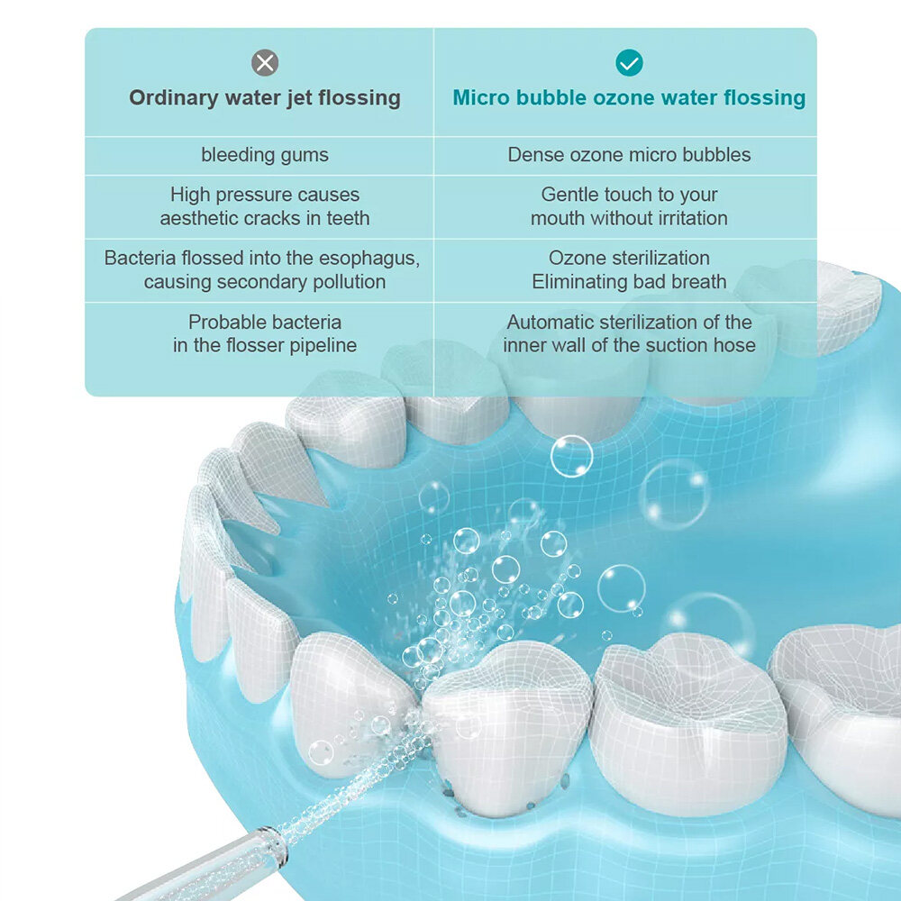 What are the advantages of water flosser?