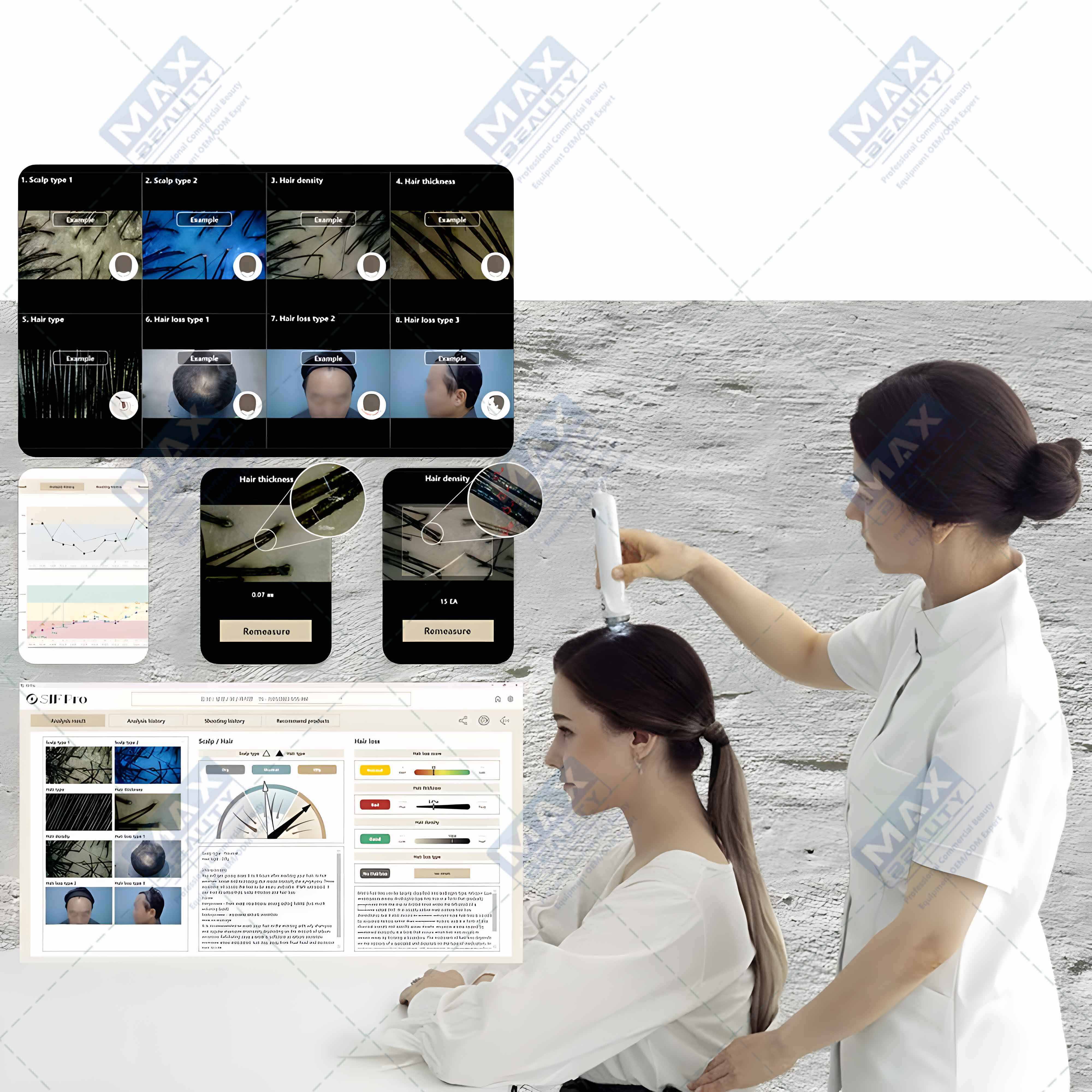 Made in Korea handheld multi-languages full HD hair and scalp analyzer machine hair analysis machine