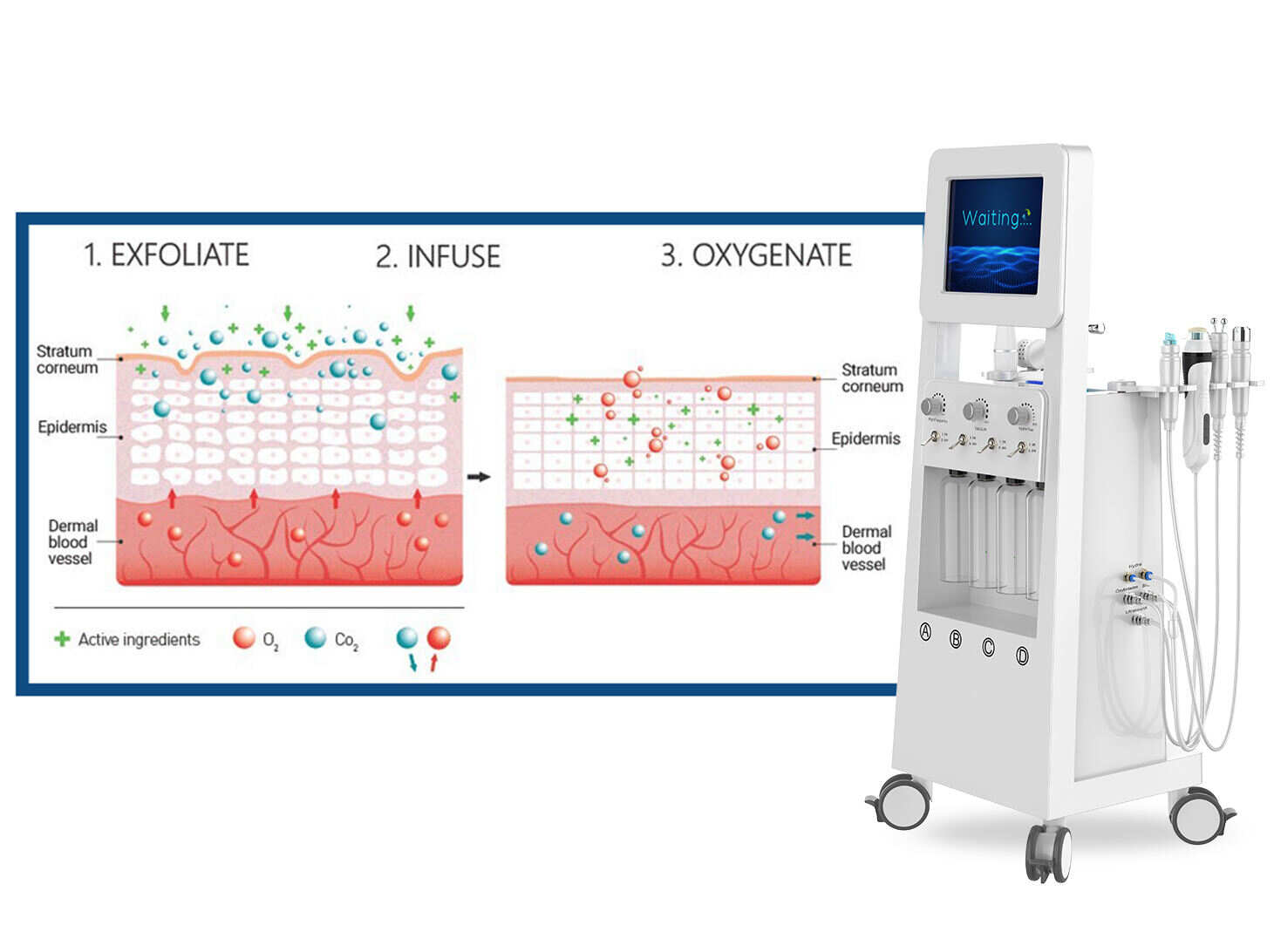 Oxygen Jet; oxygen Jet Peel jet Peel Facial Machine; jet Peel jet Peel Machine; facial Machine; hydrodermabrasion Facial Machine; hydra Facials Machine; hidra Facials Machine; oxygeneo Facials Machine; hydro Facials Machine