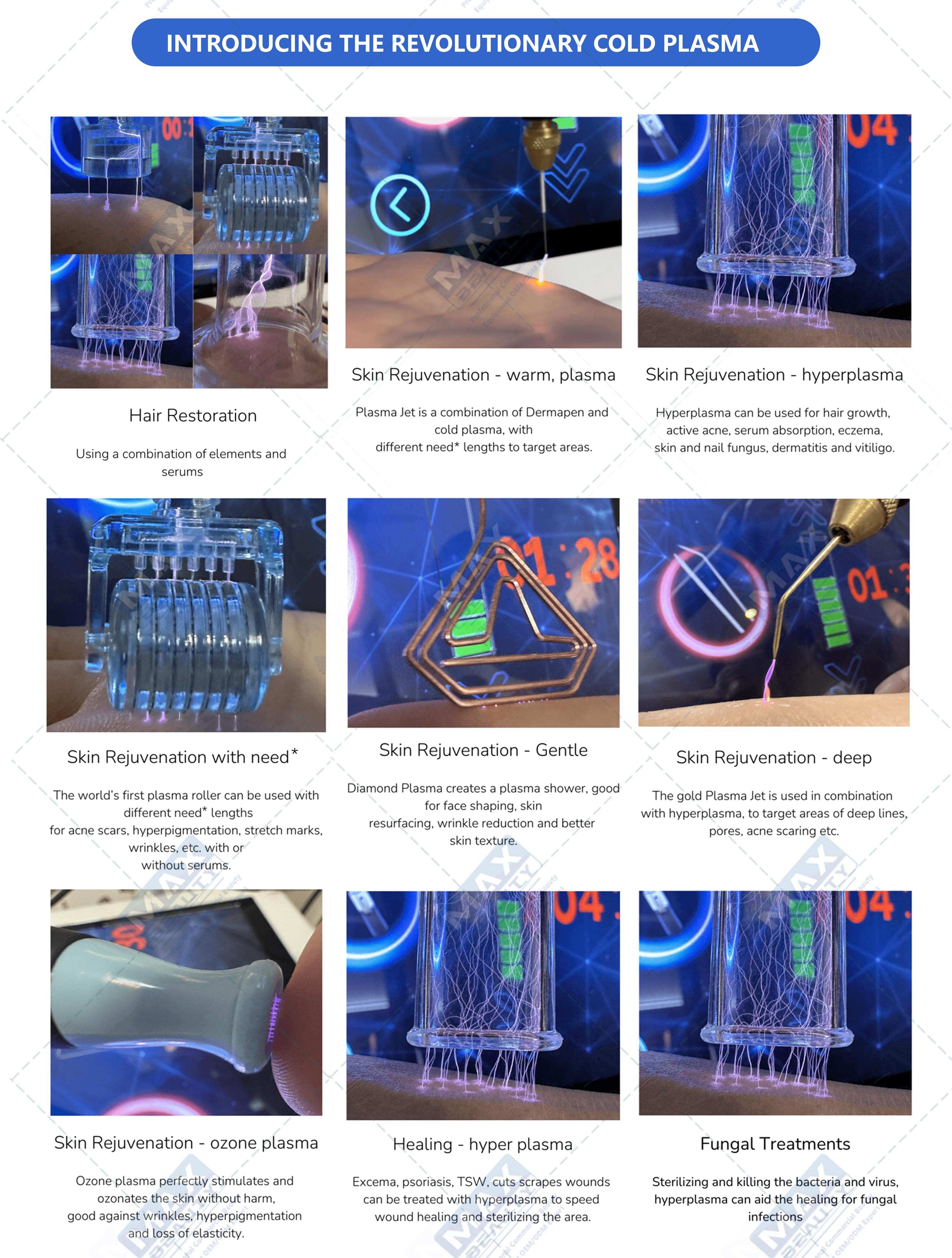 plasma pen, cold plasma, cold plasma machine, plasma machine, fibroblast plasma pen, plasma pen professional, jet plasma pen, fusion plasma, fusion plasma machine