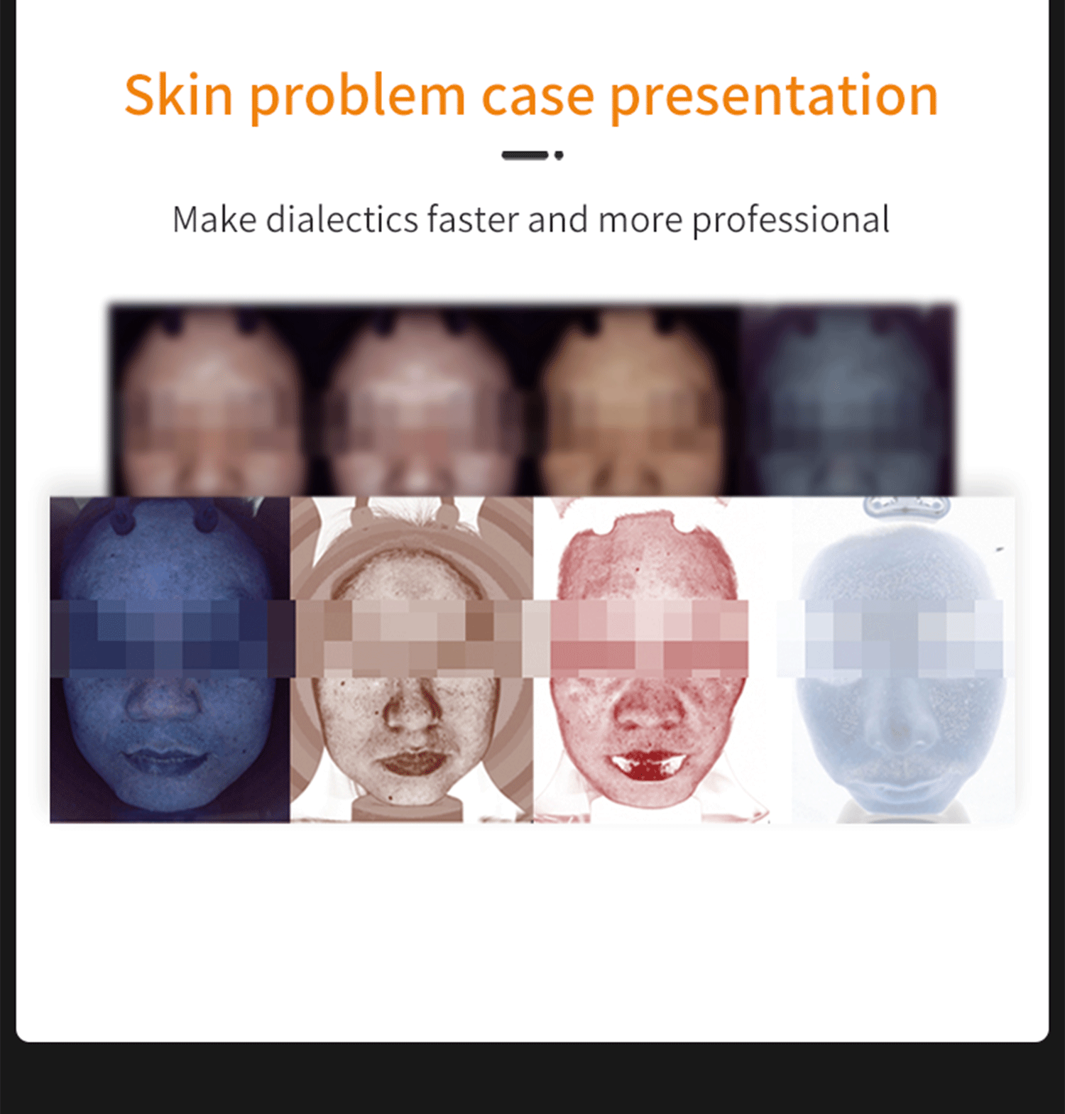 face analyzer,skin analyzer,skin analysis beauty equipment,skin scanner