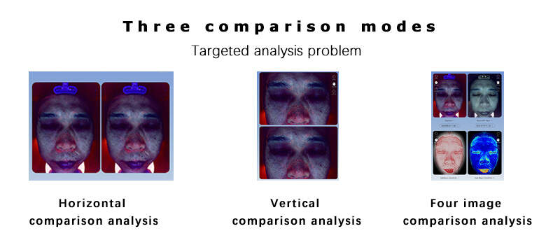 Skin analysis interface_skin analysis_Chprety beauty devices_personal skincare routine_analyze skin condition