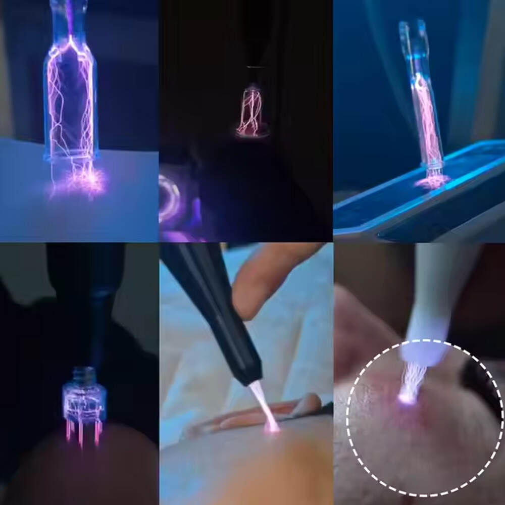 Inopisa uye inotonhora plasma pl mudziyo wembira ganda kusimbisa nzvimbo yekubvisa Plasma nyanya runako runako runako