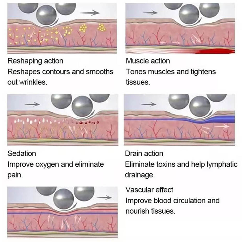 Rrotullimi i topit të brendshëm të makinës Massager Makinë Masazh Skulpting Masazh Masazh Roller i brendshëm Roller Anti Cellulite Roller Trup