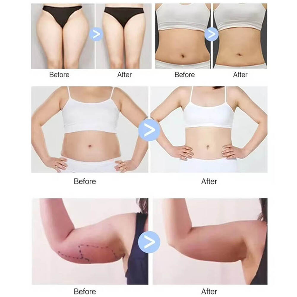 Rrotullimi i topit të brendshëm të makinës Massager Makinë Masazh Skulpting Masazh Masazh Roller i brendshëm Roller Anti Cellulite Roller Trup
