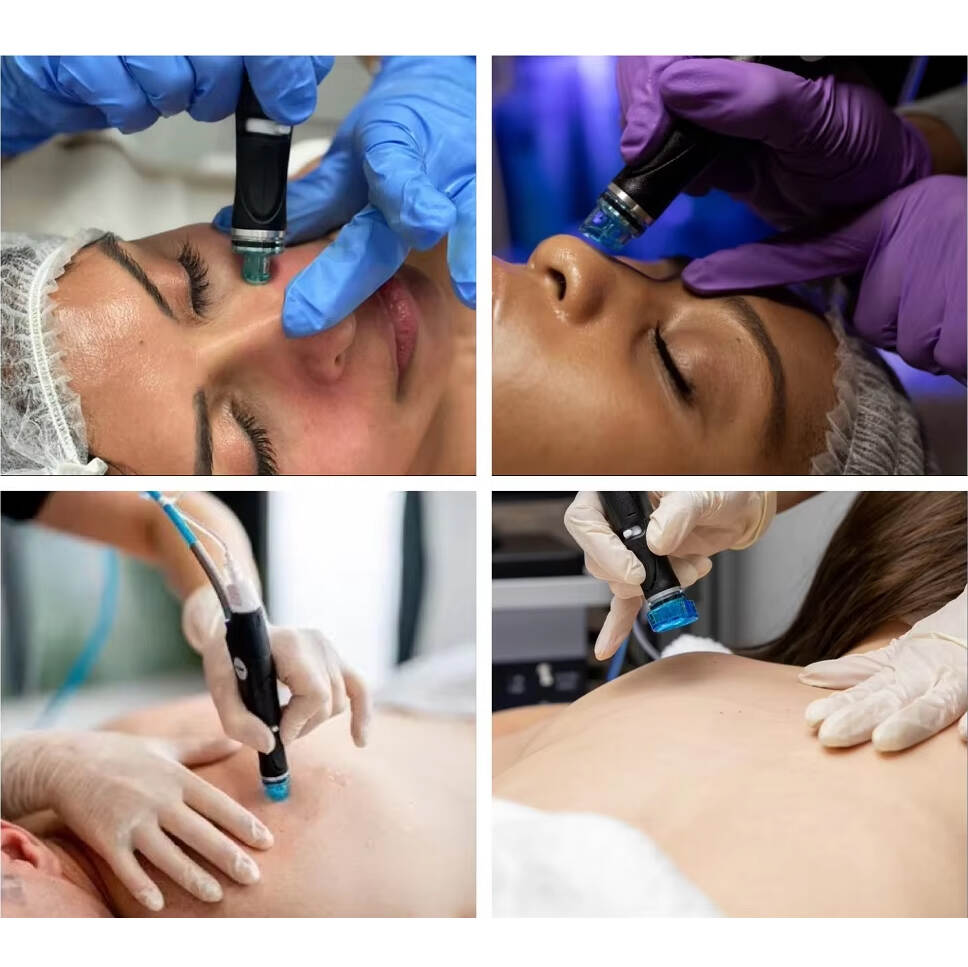 Μηχανή Dermabrasion του προσώπου. Υδρά κόκκινο φως προσώπου διαμάντια αποφλοιώνει τους πόρους του νερού φροντίδα δέρματος καθαρισμός Hydra Machine? Η μηχανή φλούδας οξυγόνου του δέρματος. Hydra Dermabrasion Spa Salon Χρησιμοποιήστε προϊόντα φροντίδας του δέρματος προσώπου
