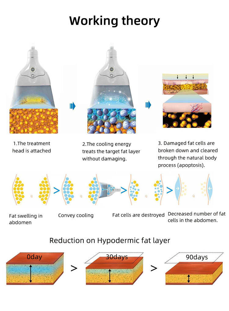 Work theory of China fat freezing 360 cryotherapy