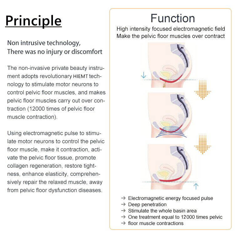 Principle of Muscle Simulation.jpg